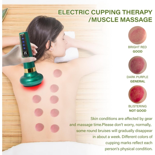 Smart negative pressure cupping massager Smart cupping massager relieves back muscle pain Green long handle scraping instrument 12 levels