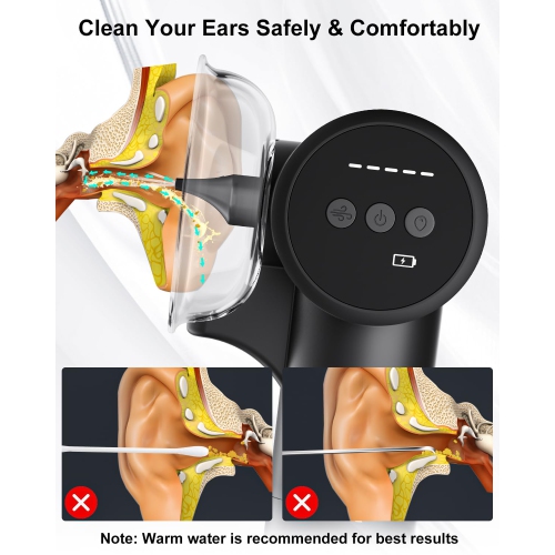 Trousse de nettoyage de cire d'oreille, nettoyeur d'oreilles électrique portatif et séchoir d'oreilles, 5 modes pour utilisation en voyage et à la