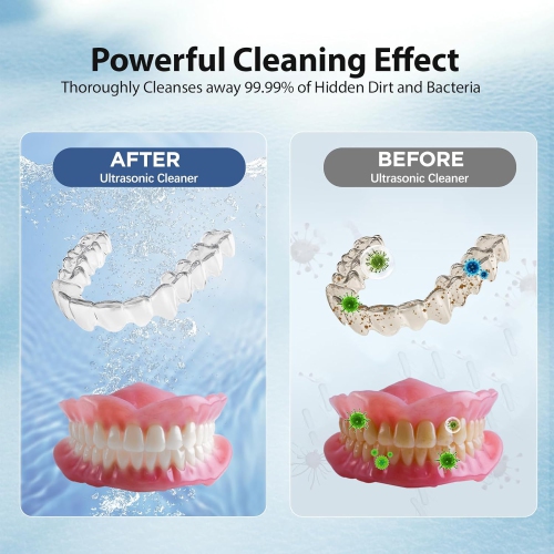 Nettoyant pour dentier ultrasonique, dispositif de retenue pour alignement UV, bijoux et montre - Noir