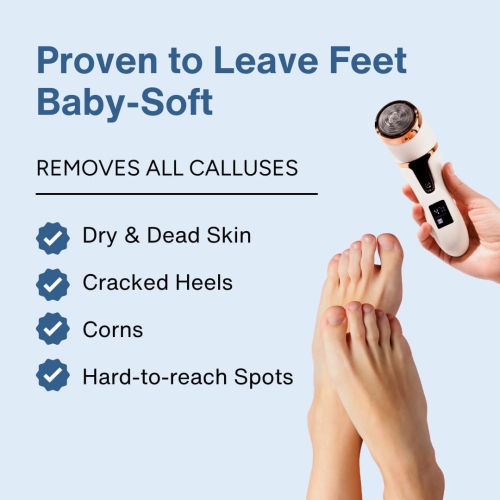 Electric Callus Remover for Feet,Portable Pedicure Tools Rechargeable Foot File Scrubber Callus Remover Tool,Foot Care Kit