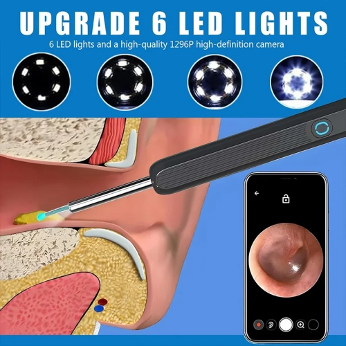 Retrait de cire d'oreille, trousse de retrait de cire d'oreille avec caméra HD, trousse de nettoyage d'oreille Otoscope avec lumière, caméra