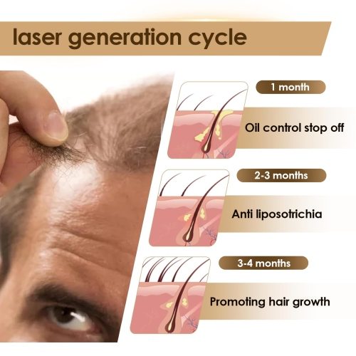 Laser Hair Growth Cap 660nm Infrared Light Therapy Red Light Therapy for Hair Loss LED Light Black Hair Regrowth Treatment for Men and Women