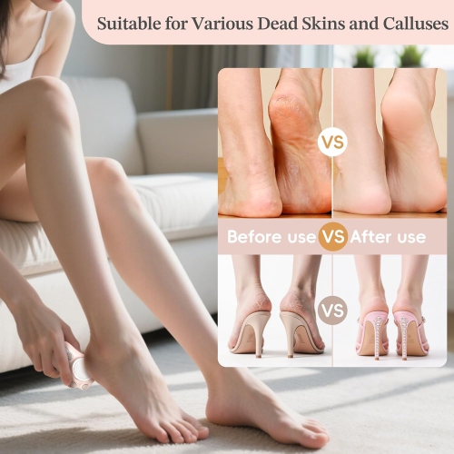 Electric Foot Callus Remover,3 Adjustable Speed,Electronic Foot File Pedicure Kits,Professional Feet Care for Hard Cracked Dry Skin,Gift for