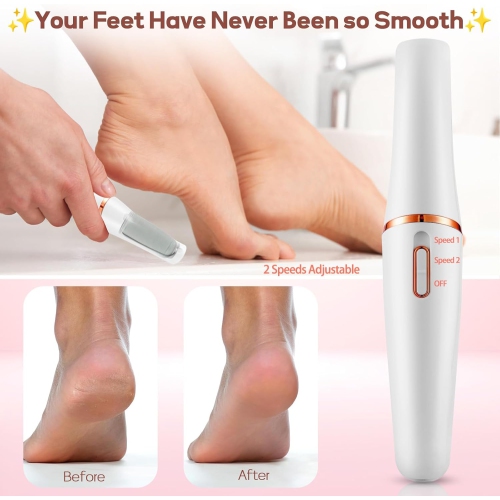 Electric Foot Callus Remover,Callus Remover for Feet,Rechargeable Portable Pedicure Tool Kit,Pedicure Wand for Feet Care,Removes Dry Hard & Dead Skin