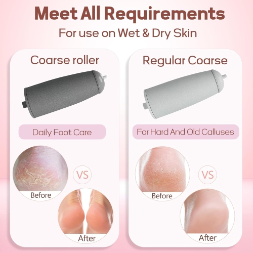 Electric Foot Callus Remover,Callus Remover for Feet,Rechargeable Portable Pedicure Tool Kit,Pedicure Wand for Feet Care,Removes Dry Hard & Dead Skin