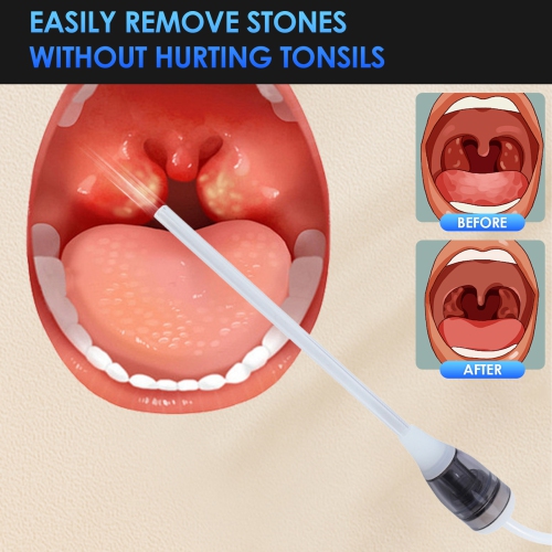 Tonsil Stones Aspirator, Electric Tonsil Stones Cleaning Tool