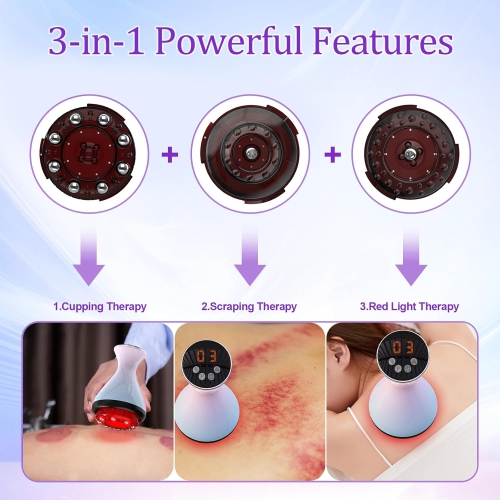Smart Cupping Therapy, Appareil de massage électrique Cupping Therapy avec lumière rouge, Appareil de massage électrique multifonction pour soulager
