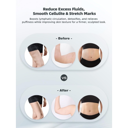 Lymphatic Drainage Massager & Anti Cellulite Massage Tool,for Reduce Stretch Marks & Cellulite,Electric Massager for Legs Arms & Belly,Body Sculpting