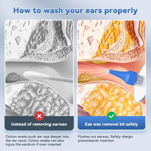 Nettoyeur d'oreilles électrique, outil d'enlèvement de cire d'oreille portatif pour la maison