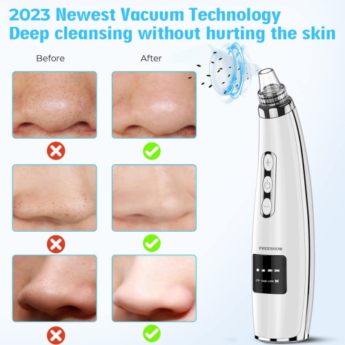 Blackhead Remover, Facial Pore Cleaner Vacuum Cleaner, USB Rechargeable Electric Acne Extractor Tool with 5 Probes for Men and Women