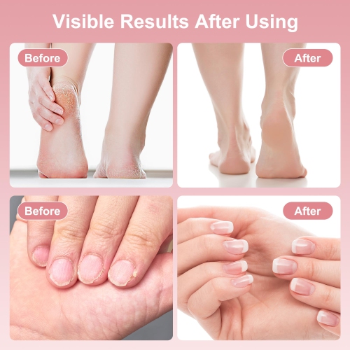 Electric Foot Callus Remover, 2 in 1 Rechargeable Foot File, 9 Speed Control, Cordless Foot Care Tool for Removing Dead Skin and Calluses