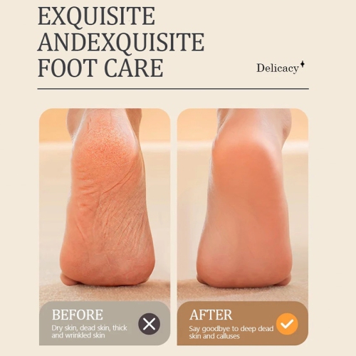 Professional Electric Foot Callus Remover, Rechargeable Electronic Foot File Pedicure Tool Kit, Foot Care for Dead Skin