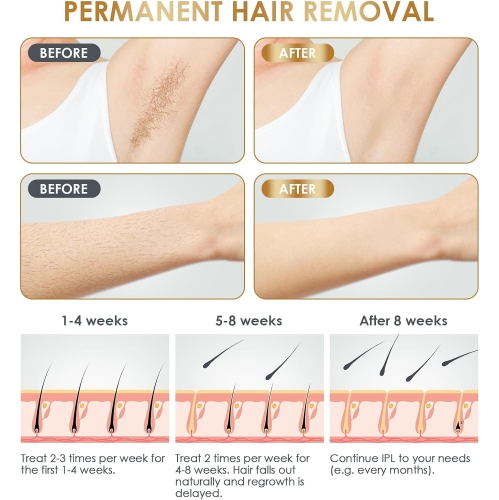 Home Hair Removal Device Portable Handheld Facial Whole Body Painless Intense Pulse Laser IPL Hair Removal Device