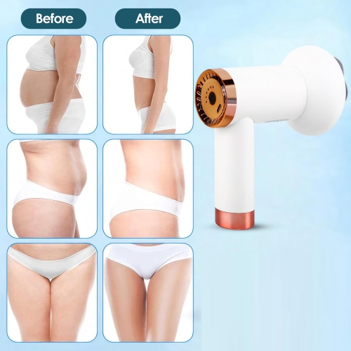 Cordless Cellulite Massager,Handheld Mini Lymphatic Drainage Massager for Belly Arms Legs,Body Sculpting Machine for Women Home Use