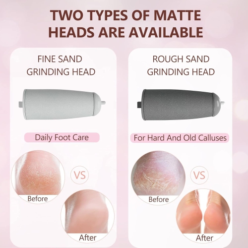 Electric Foot Callus Remover, Portable Mini Pedicure Tool for Callus Removal