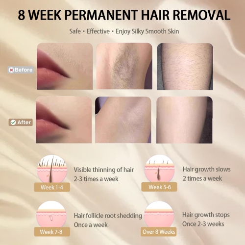 Ice Cold Laser Hair Removal Device, 999,999 Flash IPL Hair Removal Device, 5 Adjustable Levels for Legs, Underarms, Face