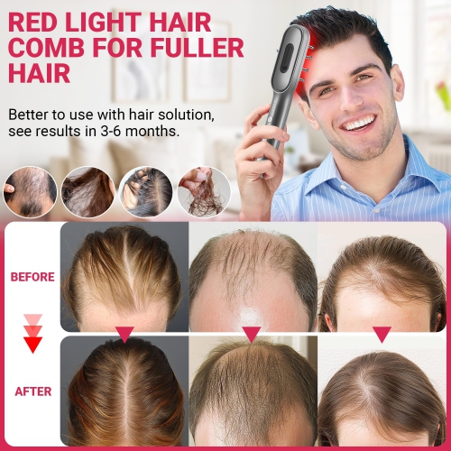 Peigne de croissance des cheveux - Red Light Therapy Electric Massage Peb Anti-Hair Loss Head Massage Brush pour Femme et Homme Soin du cuir chevelu