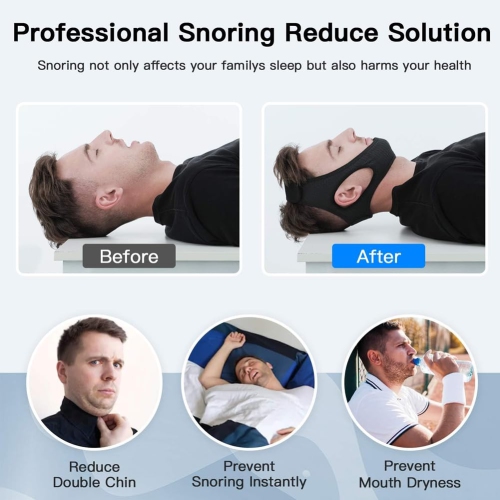Anti Snore Chin Strap - Breathable Chin Strap Snoring Solution, Effectively Reduce Snoring,Chin Strap for Sleeping