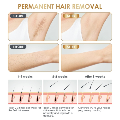 IPL Laser Hair Removal Device for Women, Painless Permanent Facial Upper Lip Bikini Line Armpits Back Legs Arms Face Body Lazer System 999,999 Flashes