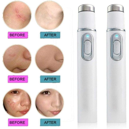 Paquet de 2 stylos pour enlever la tranche de la peau, décapant portatif la mole, tache foncée et stylo anti-acné pour les soins de la peau des femmes