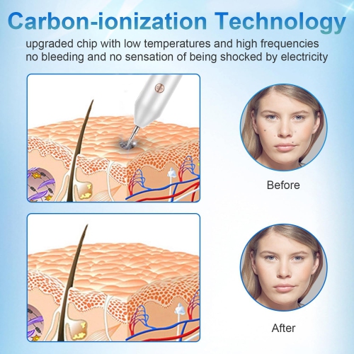 Spot And Mole Removal Pen with 9-Level Adjustable LED Spotlight Portable Rechargeable Dermatological Tool for Skin Surface