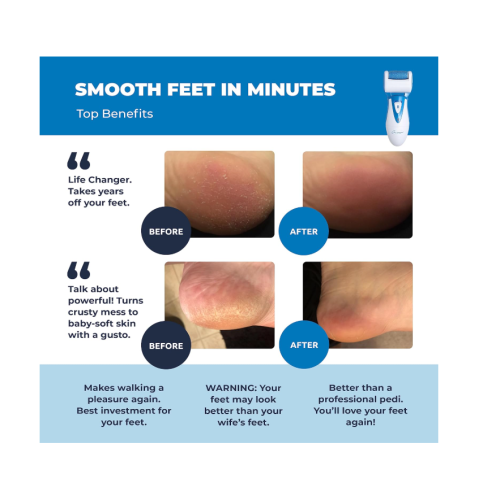 Rechargeable Electric Callus Remover and Shaver - Foot File CR900 by Own Harmony Best Pedicure Tools - Professional Spa Electronic Micro Pedi Health