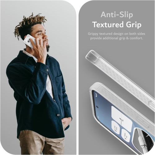 TUDIA SKN for Nothing Phone 2a/ 2a Plus Case Shockproof - Frosted Clear