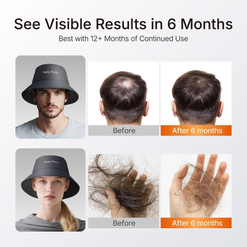 New Bucket Hat Hair Growth Cap 336 Pcs LED lights Hair Growth Cap for Hair Loss Red Light 660nm Infrared Light 850nm