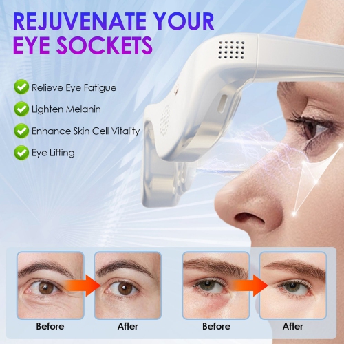 Eye Massager Relaxer Beauty Care Device Reduce Dark Circles Puffiness Wrinkles Reduction Eye Fatigue Eyecare Glasses